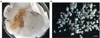Morphological and Developmental Features of Stone Cells in Eriobotrya Fruits